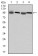 EEF2 Primary Antibody MP30190 [M5B6]