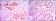 KDM4A Primary Antibody MP30087 [M5H1]