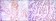 RICTOR Primary Antibody MP30090 [M7B3]