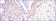 ACTA2 Primary Antibody MP30163 [M4F4]