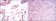 BMPR2 Primary Antibody MP30183 [M1F12]