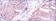 BMPR2 Primary Antibody MP30183 [M1F12]