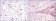 CD1A Primary Antibody MP30187 [M7A7]