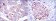EEF2 Primary Antibody MP30190 [M5B6]