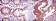 OTX2 Primary Antibody MP30218 [M1H12G8B2]