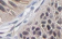 NF-kB p65 Primary Polyclonal Antibody MAF5006