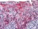 KRT15 Primary Antibody MP20410 [M6E7]