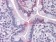 FABP2 Primary Antibody MP20416 [M9A9B7B3]