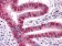 MUM1 Primary Antibody MP30048 [M4G10]