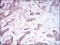 BMPR1A Primary Antibody MP30446A [M4B7B2]