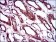 BMPR1A Primary Antibody MP30446A [M4B7B2]