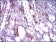 CK5 Primary Antibody MP30468P  [M10C11E6]