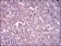 ITGA2B Primary Antibody MP30485P[M2E10C9]