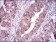 ITGA2B Primary Antibody MP30485P[M2E10C9]