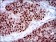 PLAGL1 Primary Antibody MP30530 [M8D8C5]