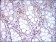CD14 Primary Antibody MP30585 [M1H5D8]