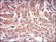 PRKAG1 Primary Antibody MP30598 [M7H3E9]