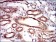 PRKAG1 Primary Antibody MP30598 [M7H3E9]