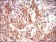 EIF2A Primary Antibody MP30599 [M3A7B11]