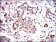 PRKAG1 Primary Antibody MP30601 [M4A1G9]