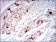 TERF2 Primary Antibody MP30607 [M3H6B4]
