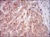 MSTN Primary Antibody MP30622 [M6E4E6]