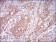 MSTN Primary Antibody MP30622 [M6E4E6]