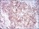 CAMK2G Primary Antibody MP30624 [M8G10C1]