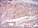 CAMK2G Primary Antibody MP30624 [M8G10C1]