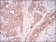 MSTN Primary Antibody MP30626 [M6E4B2]