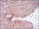DSG3 Primary Antibody MP30627 [M6G2C11]