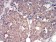 IRAK3 Primary Antibody MP30787 [M6G9G2]