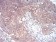 IRAK3 Primary Antibody MP30787 [M6G9G2]