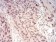 WTAP Primary Antibody MP30788 [M6B6B6]