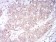 SK2 Primary Antibody MP30888 [M9C5E1]