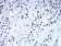 CBX5 Primary Antibody MP30923 [M1B10B2]