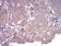 CFHR5 Primary Antibody MP30966 [M3E1E10]
