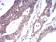 ALDH6A1 Primary Antibody MP30974 [M6H9B8]
