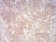 PYCARD Primary Antibody MP31008 [M1C3D3]