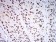 KDM1A Primary Antibody MP31034 [M3F9A3]