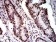 DDX1 Primary Antibody MP31066 [M3E5E2]