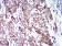 BNIP3 Primary Antibody MP31072 [M6A5F7]