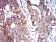 BNIP3 Primary Antibody MP31072 [M6A5F7]