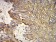 KRT10 Primary Antibody MP31133 [M3C2F5]