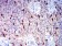 AURKA Primary Antibody MP31238 [M2D8A4]