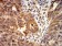 ACVR1 Primary Antibody MP31245 [M2E2C11]