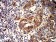 ACVR1 Primary Antibody MP31245 [M2E2C11]