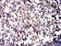 CD11a Primary Antibody MP31525  [M5G7C5]