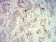 PCK2 Primary Antibody MP31650  [M3D3D9]