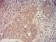 KMT2C Primary Antibody  MP31664 [M6D1B9]